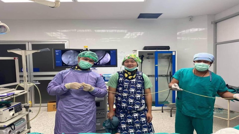 Thaise chirurgen verwijderen tijdens een operatie een 2-meter lange lintworm bij een man