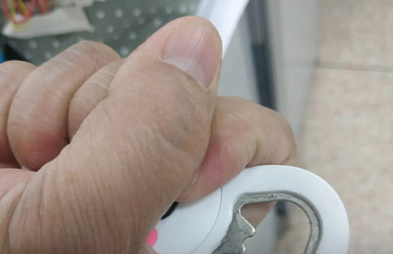 Artsen waarschuwen het Thaise mannen om géén fratsen uit te halen nadat een Thaise man penis een flesopener verkracht