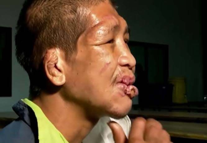 Thailand | Werkgeefster in Singburi beschuldigd van het folteren en martelen van een Thaise man