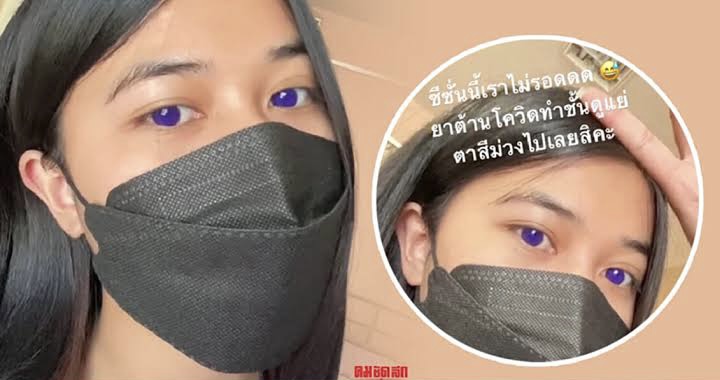 De ogen van Thaise vrouw verandert in de kleur indigo na inname van Favipiravir pillen