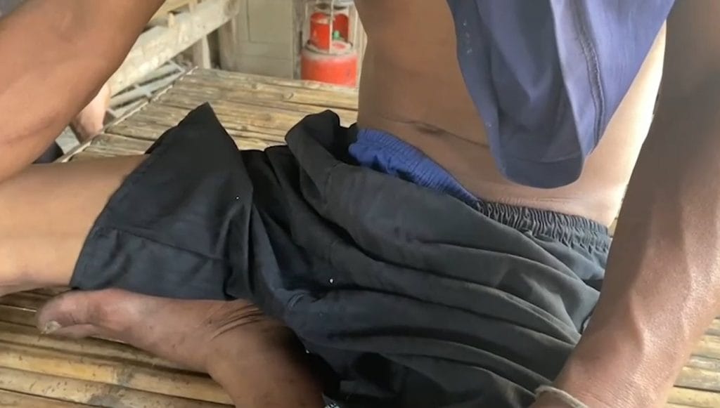 Thaise vrouw valt dronken Thaise man aan met harpoen – 17 hechtingen aan geslachtsdeel