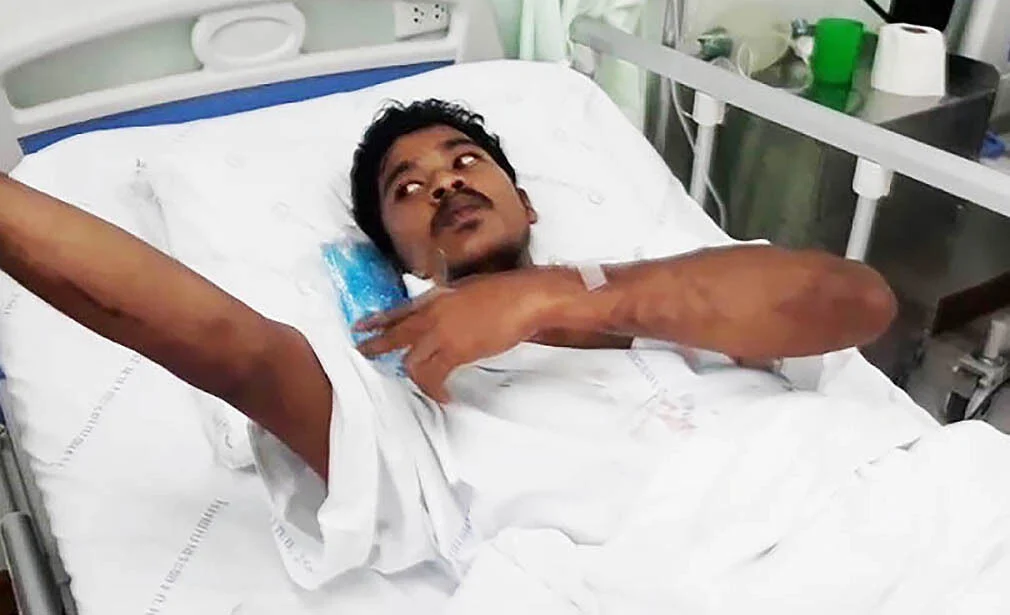 Thaise zwemmer herstelt voorspoedig na ‘gespietst’ te zijn door een naaldvis in Trat