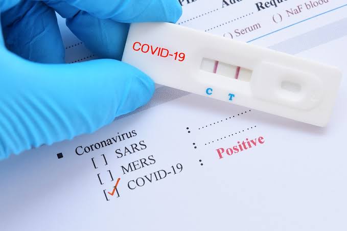 Minder gerealiseerde Covid19 testen  kunnen ertoe leiden dat er minder infecties worden gemeld tijdens Songkran 