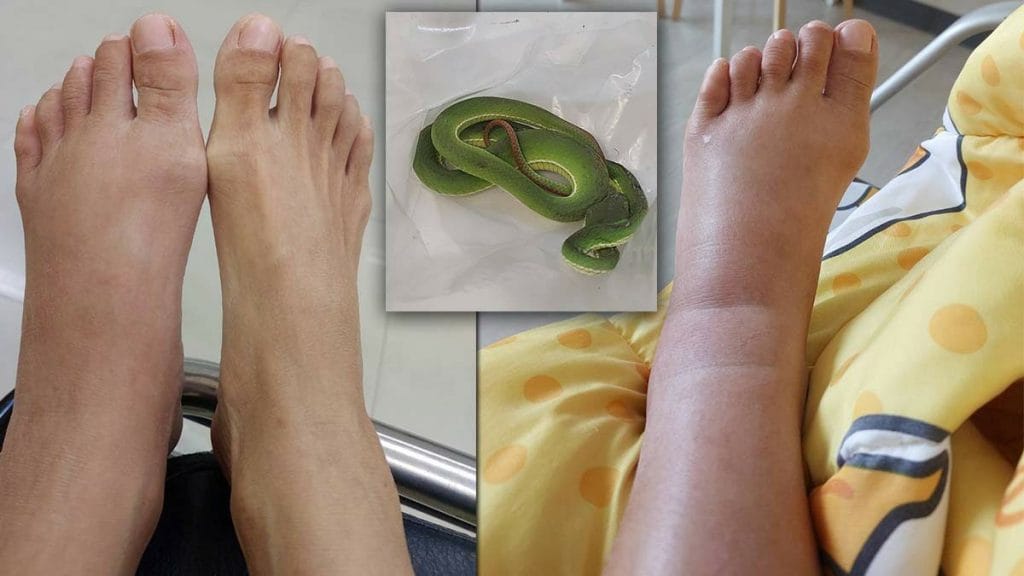 Thaise vrouw in een bekend warenhuis in Bangkok door een groene pitadder gebeten, het management weigert verantwoording te nemen