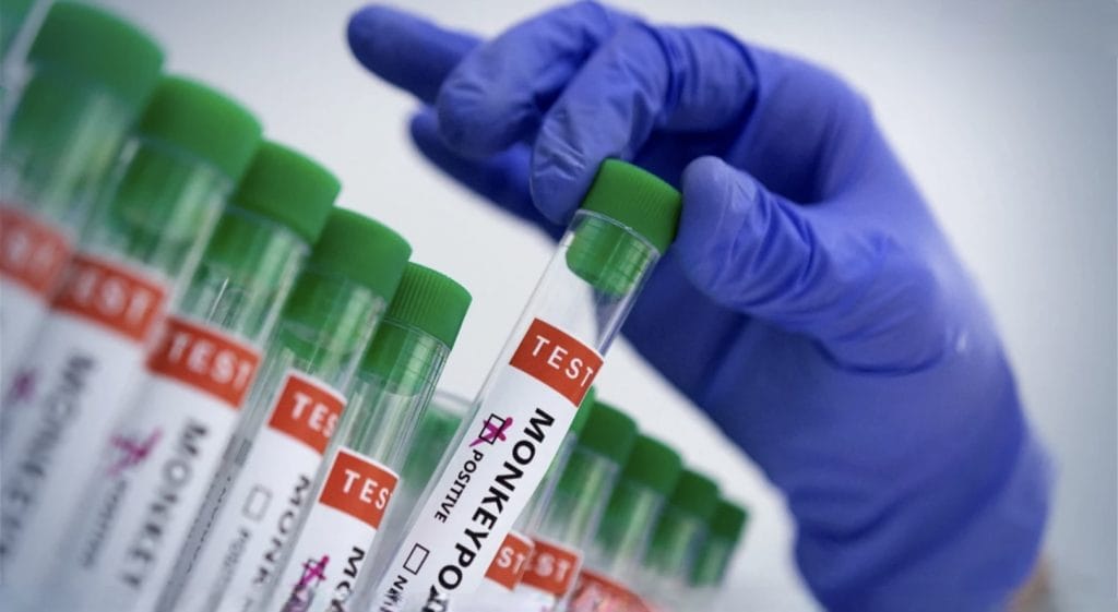 Medewerker in de toeristische servicebranche in Zuid-Thailand positief op apenpokken getest