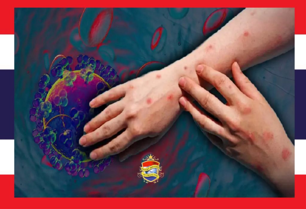 Thailand registreert het eerste dodelijke slachtoffer met apenpokken