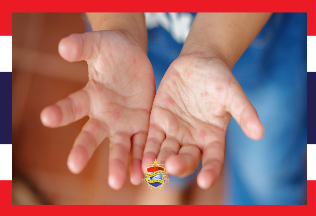 Mond en klauwzeer vormt een bron van zorgen op de scholen in de Thaise hoofdstad Bangkok