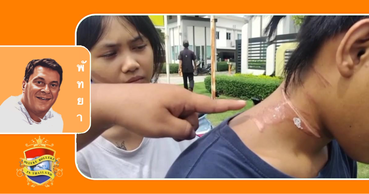 Broer en zus raken in Pattaya raken flink gewond door over de weg bungelende kabels