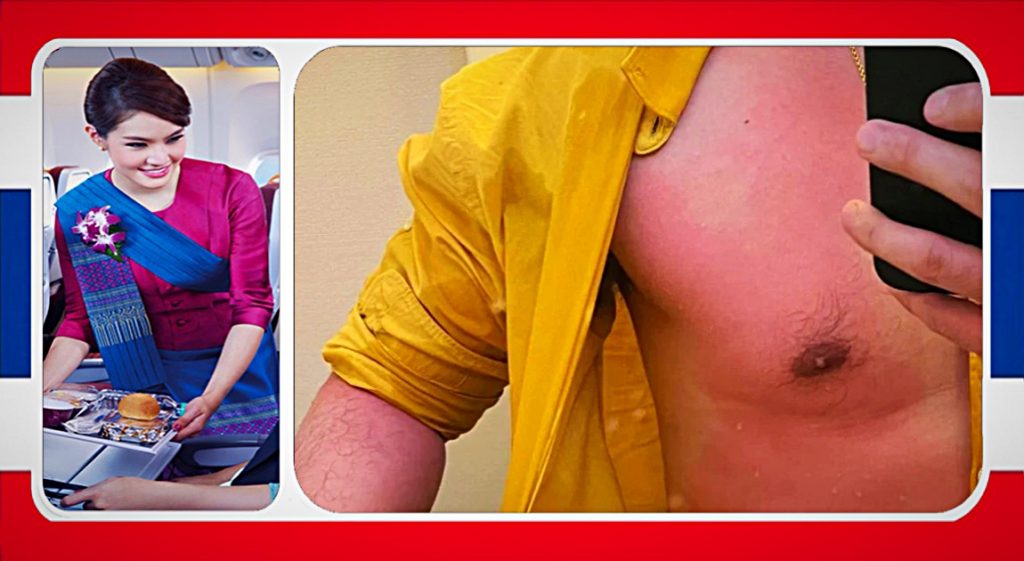 Hete koffie van Thai Airways zorgt tijdens de vlucht voor pijnlijke vliegervaring bij een passagier 