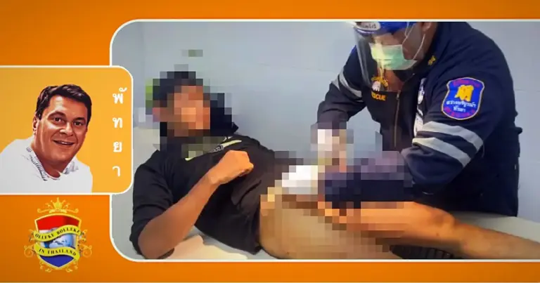 Een 38-jarige man uit Pattaya droeg een “Cockring” om zijn uithoudingsvermogen te vergroten, maar uiteindelijk bleef de ring hangen.