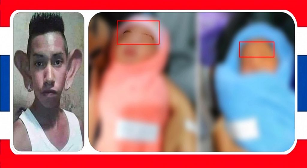 Ziekenhuis in Centraal-Thailand verwisselt per ongeluk baby’s met elkaar, de vader zag het aan de wenkbrauwen en oren 