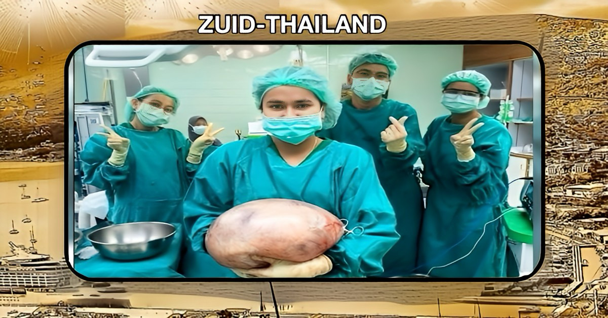 Artsen in Zuid-Thailand verwijderen bij een vrouw een jarenoude ovariumcyste van 8 kg