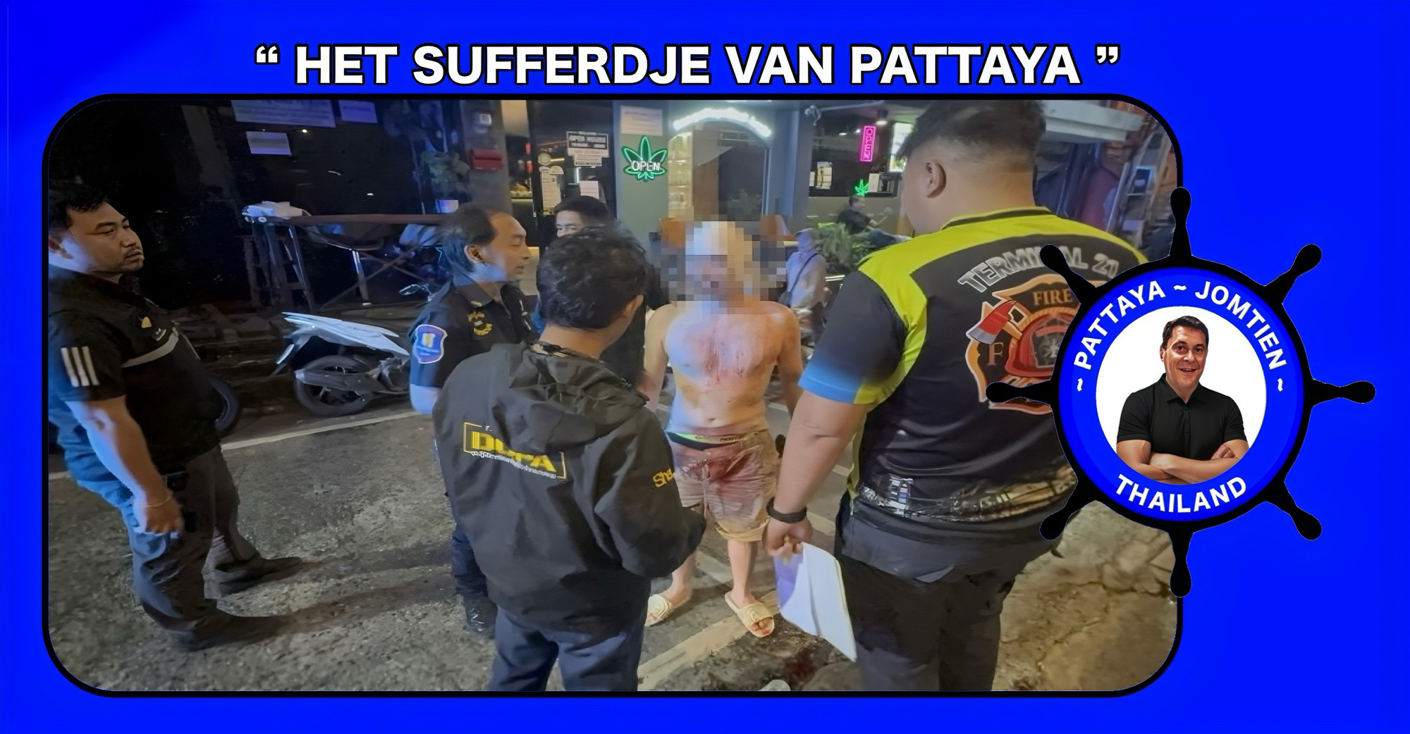 27-jarige Russische toerist in Walking Street van Pattaya mishandeld, hij beweert dat een groep Thaise mannen hem te grazen hadden genomen