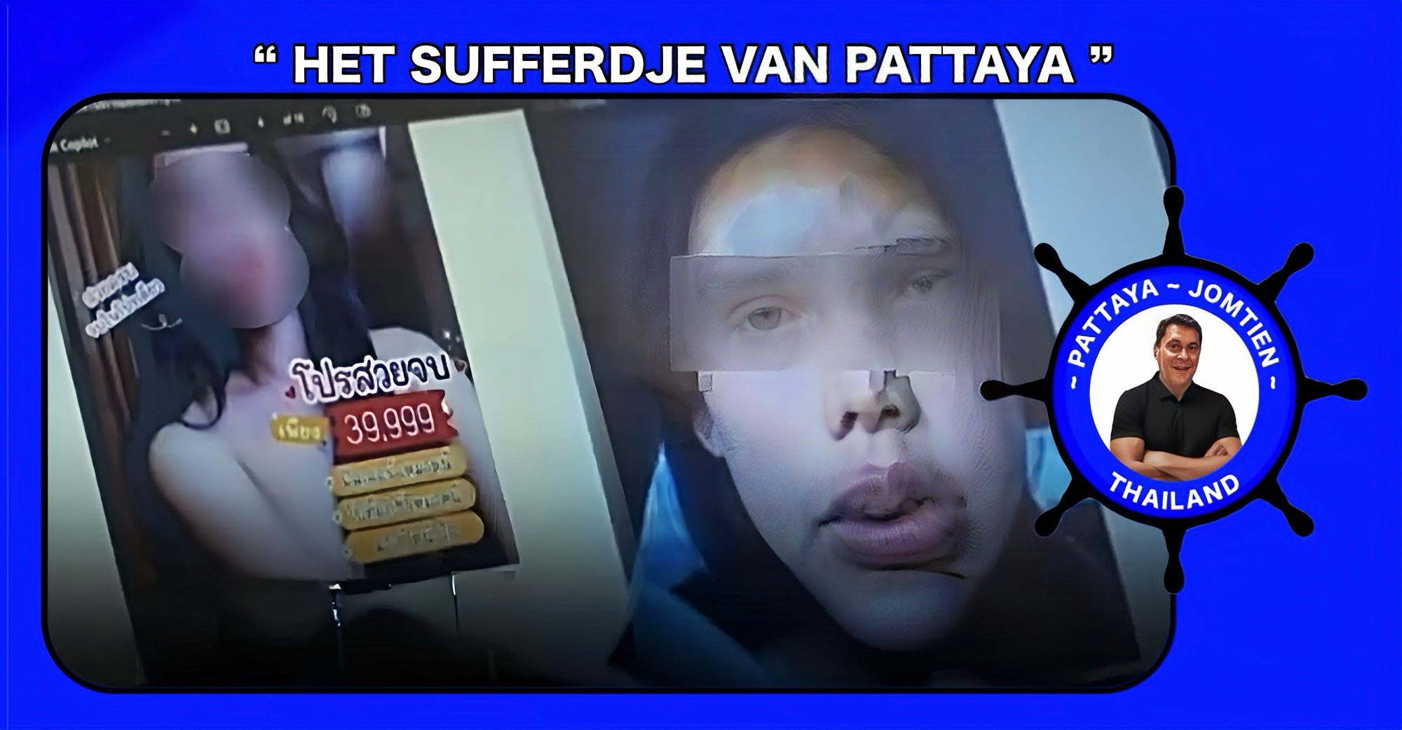 Een vrouw in Pattaya waarschuwt dat een Botox-behandeling bij haar resulteerde in een ‘blowtox’-mondje