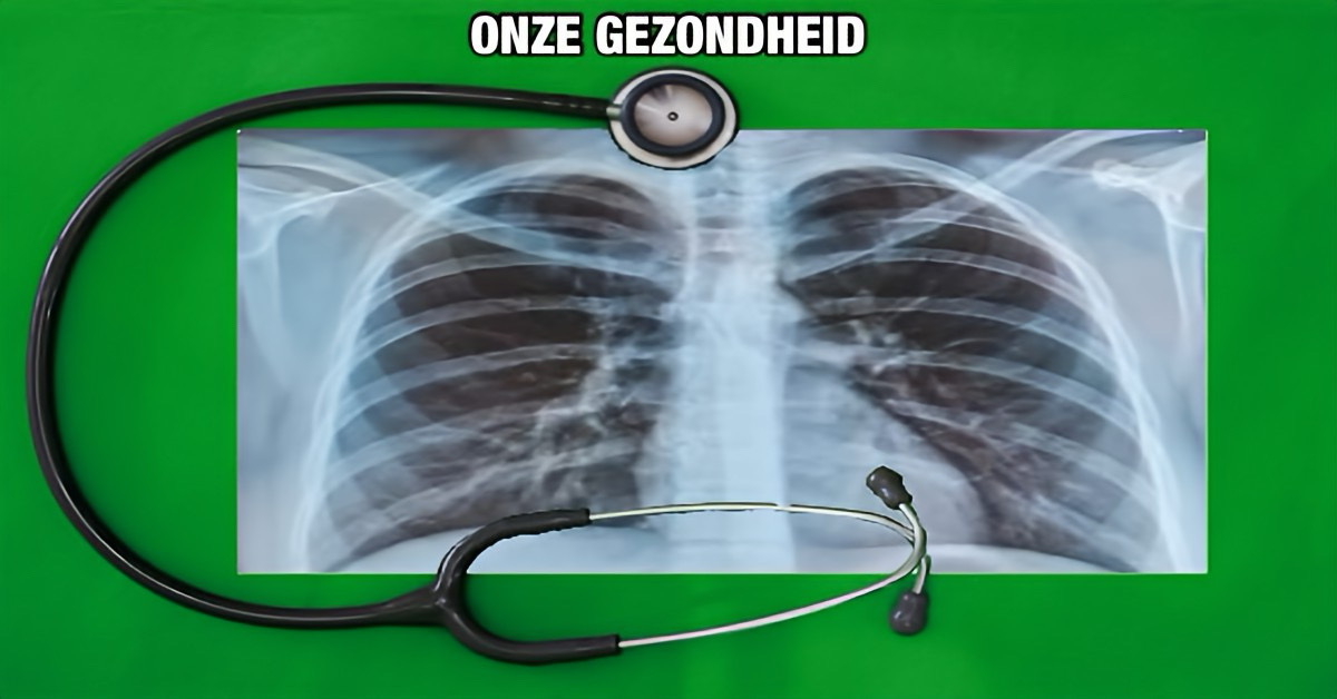 Ernstige longproblemen in Noord-Thailand zijn door een Thaise professor aan de voortdurende PM2.5 vervuiling gelinkt.