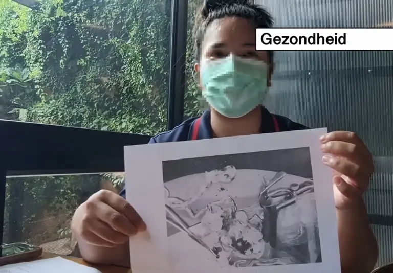 Suranaree-ziekenhuis in Thailand biedt excuses aan wegens achtergebleven vaginaal gaasje.
